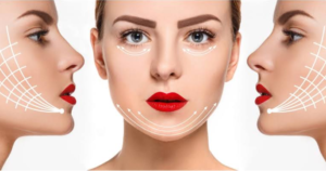 Is It Time for a Facelift in Dubai, and What Should You Want From It?